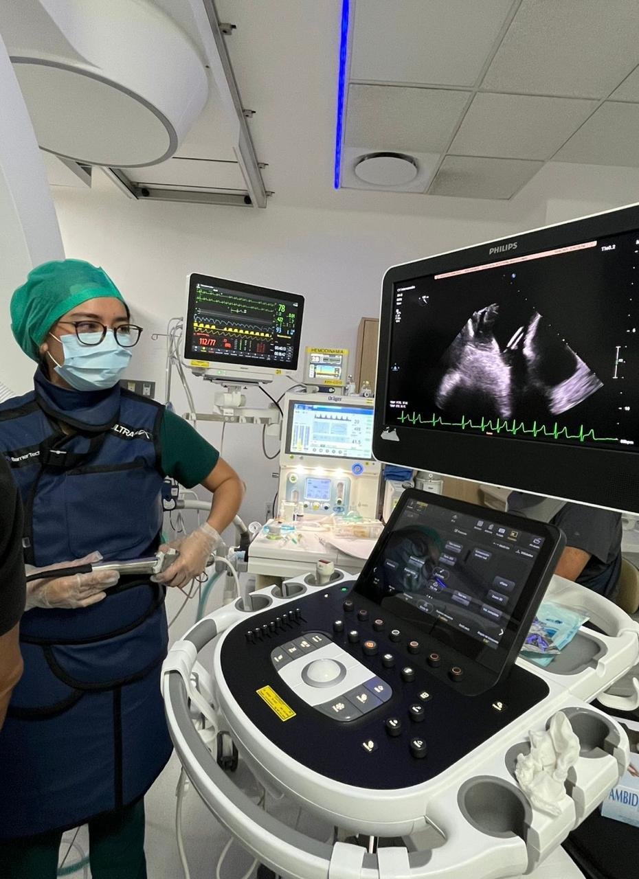 mejor-cardiologo-ecocardiografia-cdmx